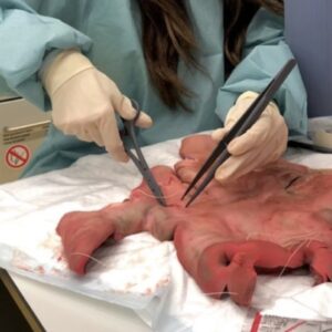 scalpel IV